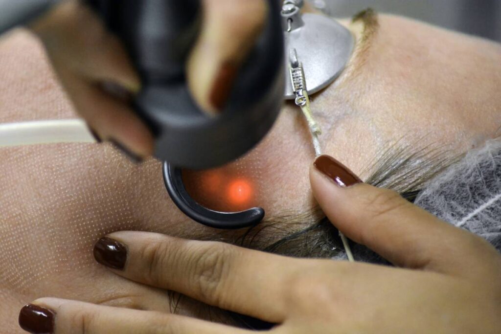 arrêt tabac réflexologie auriculaire laser